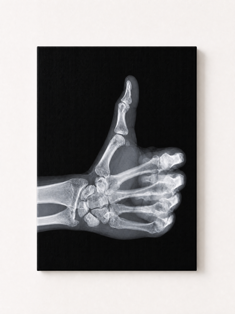 Baddie X-Ray Thumbs Up Rhinestone Canvas Art Kit