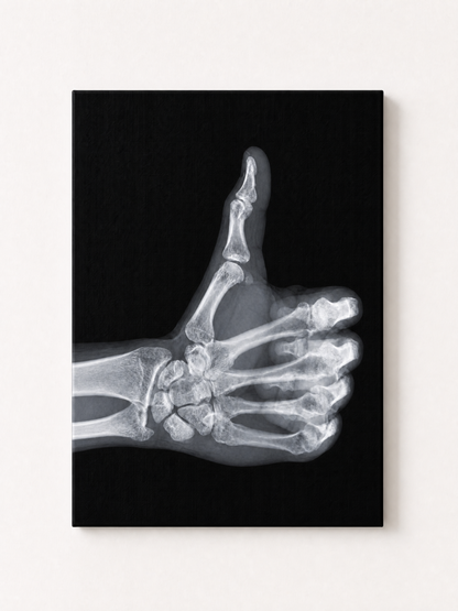 Baddie X-Ray Thumbs Up Rhinestone Canvas Art Kit
