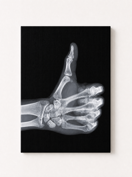Baddie X-Ray Thumbs Up Rhinestone Canvas Art Kit