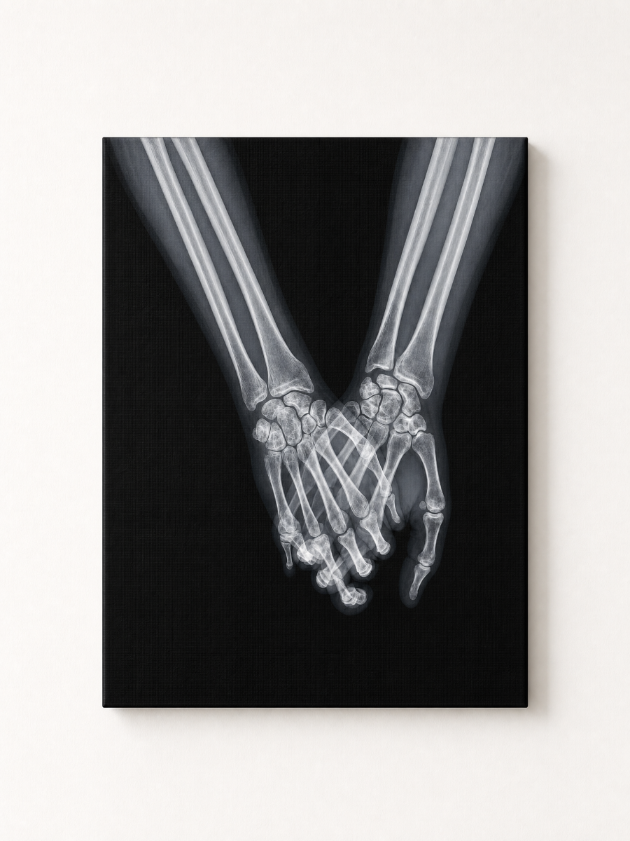 X-Ray Hand-in-Hand Rhinestone Canvas Art Kit (Valentine's Day Edition)