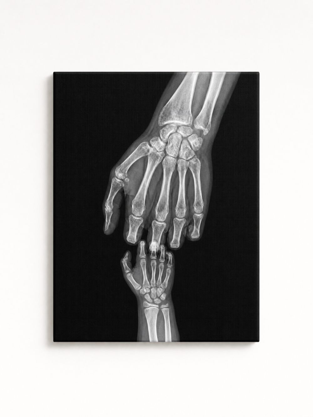 X-Ray Endless Love Rhinestone Canvas Art Kit (Father's Day Edition)